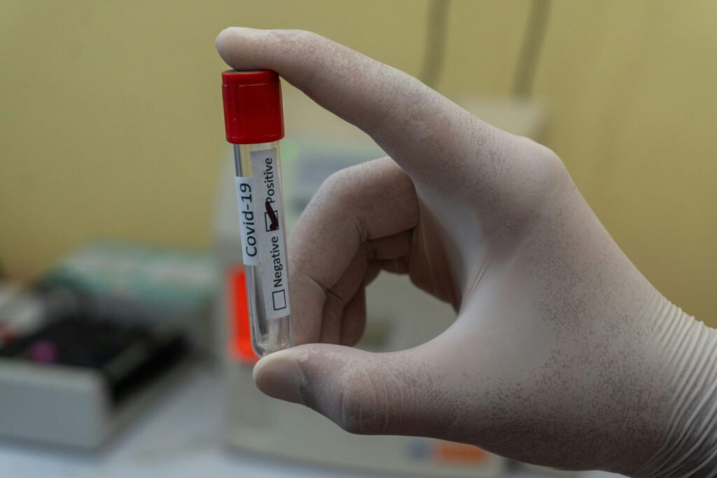 Los casos de COVID-19 están disminuyendo y no se reportan hospitalizaciones