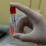Los casos de COVID-19 están disminuyendo y no se reportan hospitalizaciones