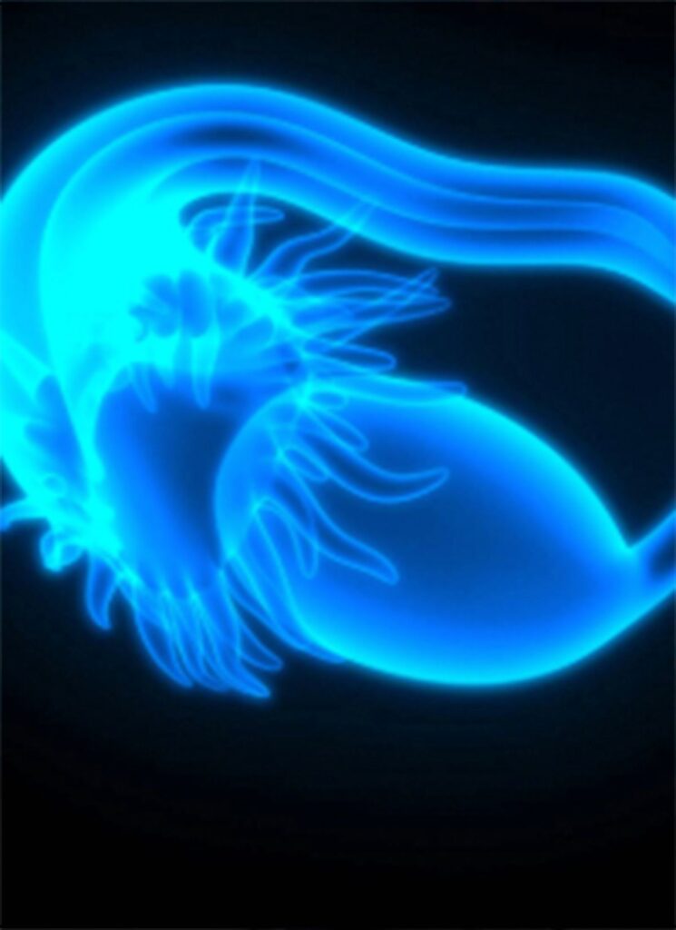 Health Canada confirma el monytaximab sorvtansin frα+ platino un cáncer epitelial de ovario