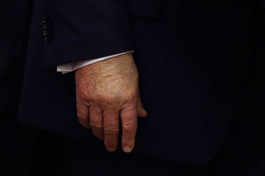 Un primer plano de la mano del presidente Donald Trump mientras pronuncia el discurso del 2 de septiembre en la Oficina Oval de la Casa Blanca en Washington.